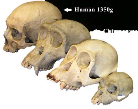 Skulls